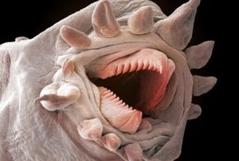 cacing apa yang bisa hidup di tubuh manusia