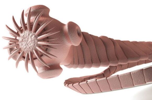 parasit dari tubuh manusia